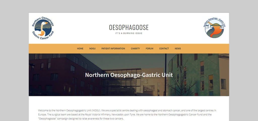 Oesophagoose